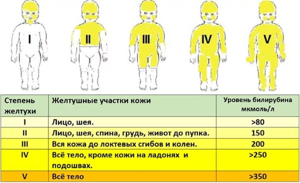 Степени желтухи Степени желтухи