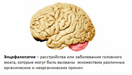 Самым опасным последствием повышенного билирубина является энцефалопатия Самым опасным последствием повышенного билирубина является энцефалопатия