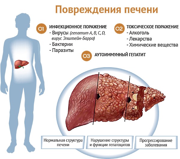 Помимо алкоголя, печень страдает и от других внешних факторов, что увеличивает нагрузку на орган