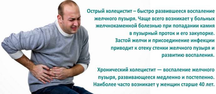 Холецистит