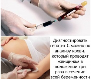 Беременность при гепатите С