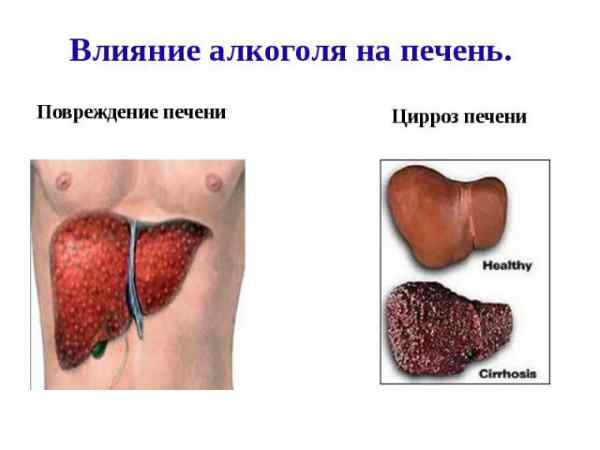 Употребление алкоголя может привести к указанным на картинке последствиям. Препарат поможет избежать их развития