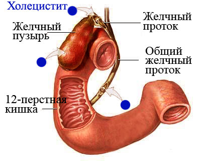 Влияние холецистита
