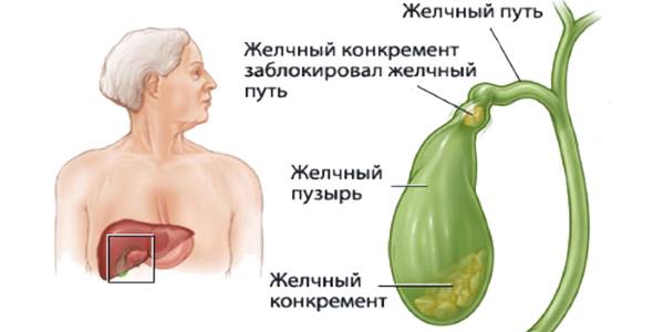 Блокировка работы выводящей системы