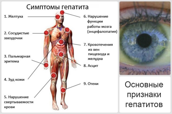 Лекарство поможет избавиться от таких симптомов в процессе борьбы с гепатитом