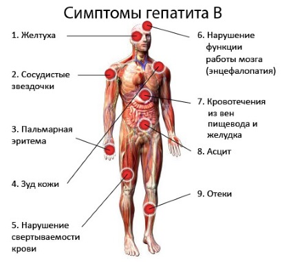 Симптомы гепатита В
