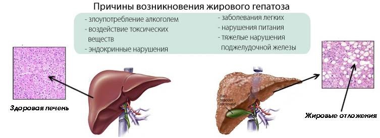 Причины