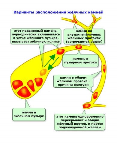 Варианты
