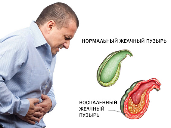 Схематично изображено сравнение нормального и воспалённого органа