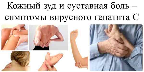 Симптомы гепатита Ц