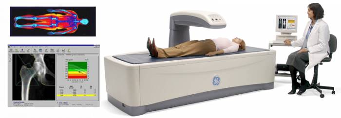 DEXA Scan – золотой стандарт инструментальной диагностики плотности костной ткани DEXA Scan – золотой стандарт инструментальной диагностики плотности костной ткани