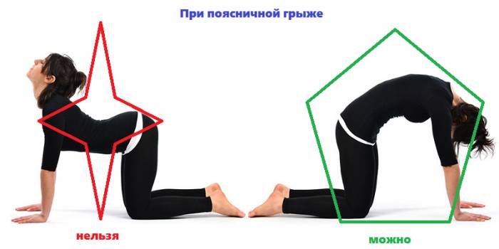 Одна из самых распространенных ошибок во время занятий ЛФК при грыже в пояснице Одна из самых распространенных ошибок во время занятий ЛФК при грыже в пояснице