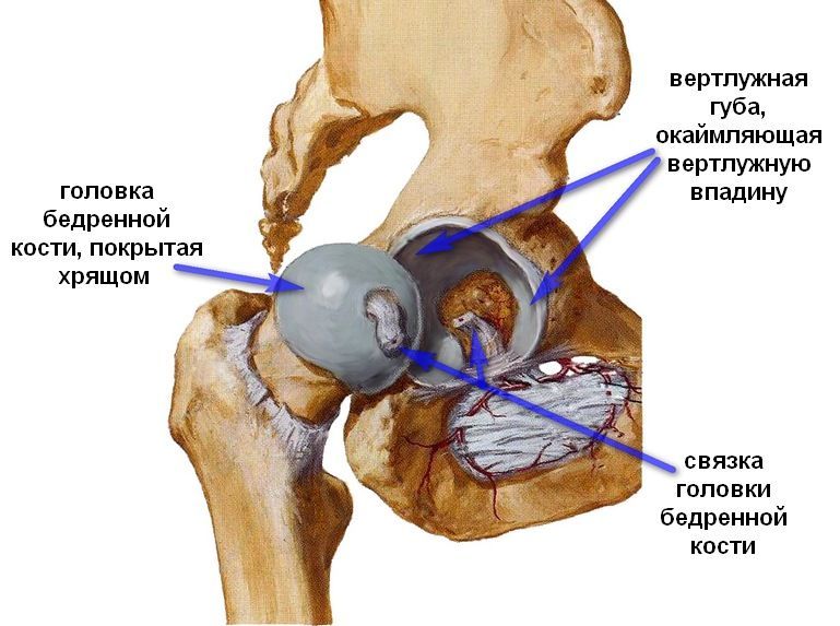 Перелом в тазобедренном суставе. Перелом в тазобедренном суставе.