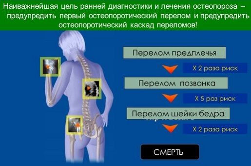 При остеопорозе могут возникать различные переломы. При остеопорозе могут возникать различные переломы.