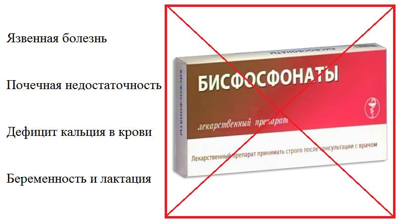 Противопоказания к лечению бисфосфонат-препаратами Противопоказания к лечению бисфосфонат-препаратами