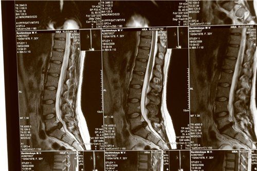 Самым безопасным методом исследования является магнитно-резонансная томография Самым безопасным методом исследования является магнитно-резонансная томография