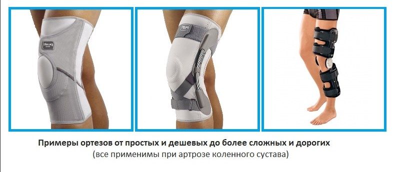 Цены на ортезы для колена могут значительно колебаться. Цены на ортезы могут значительно колебаться.