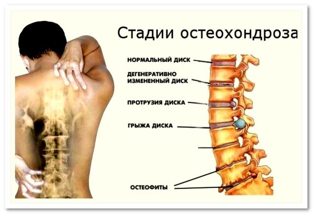 Запущенное патологическое состояние развивается по следующему сценарию Запущенное патологическое состояние развивается по следующему сценарию